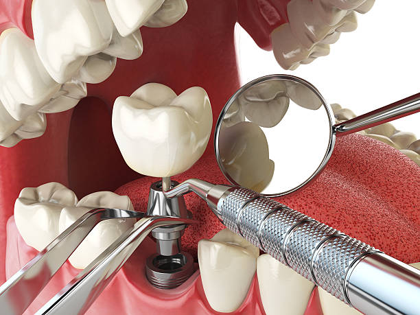 Best Weekend Emergency Dentist in Van Meter, IA